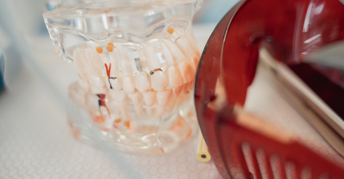 Dental Implant Cost Calculator | USD Planning Band + Charts