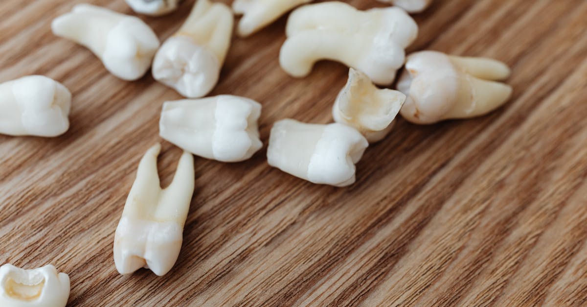 Single tooth dental implant cost estimate & bone graft budgeting (2026) | CalculaSite